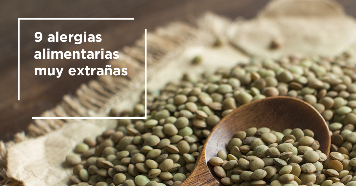 sanitas's tweet photo. Las 9 alergias alimentarias más extrañas:

https://t.co/a9ZCPYxOaf https://t.co/sw3yQOE1Ux