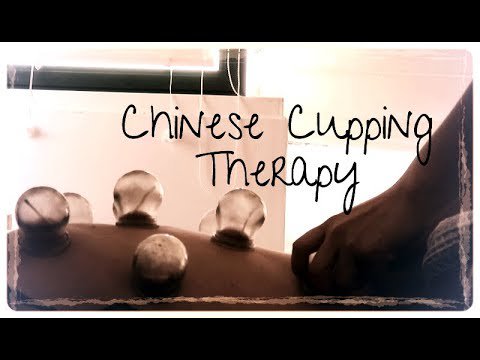 VASMRVideo's tweet photo. An interesting video:
Trying the cupping therapy with my Chinese friend - for back pain ASMR
https://t.co/pmAjSw3iPp https://t.co/SqNSdaPpbW