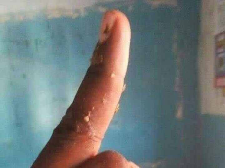 DaudMakindo's tweet photo. Nasikiaa huko taifa yanga a,k,a makohozi fc kapimwa tezi dume taiga @zittokabwe @Yanga_FB_Fans  @ @HajiManara https://t.co/P3u7KwlUIX