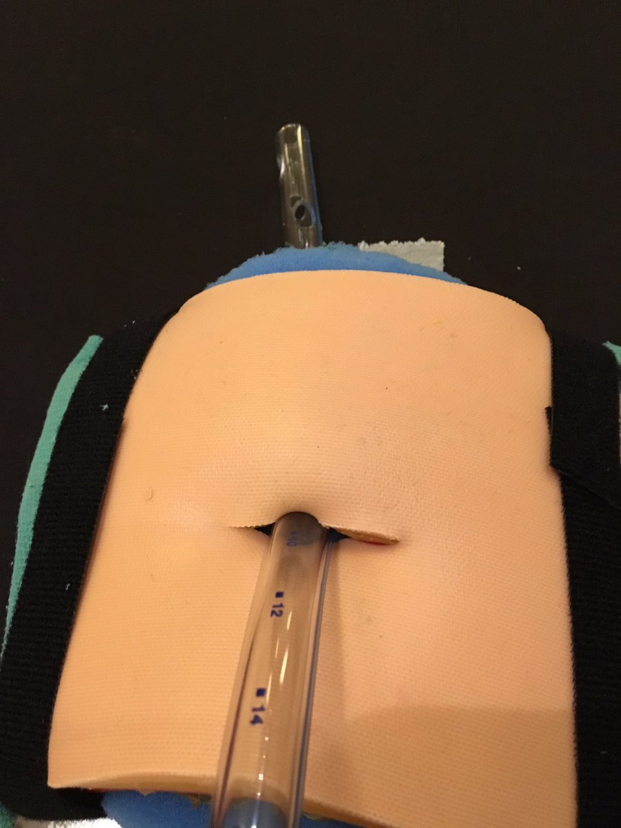 LKolarczyk_MD's tweet photo. Chest Decompression Workshop was a huge success!  Lots of hands on time placing chest tubes, needle decompressions, and plenty of learning and discussion.  ...and it was a lot of fun!  #SCA2018TAS #SCA2018AM https://t.co/WJOMGJ0SY4