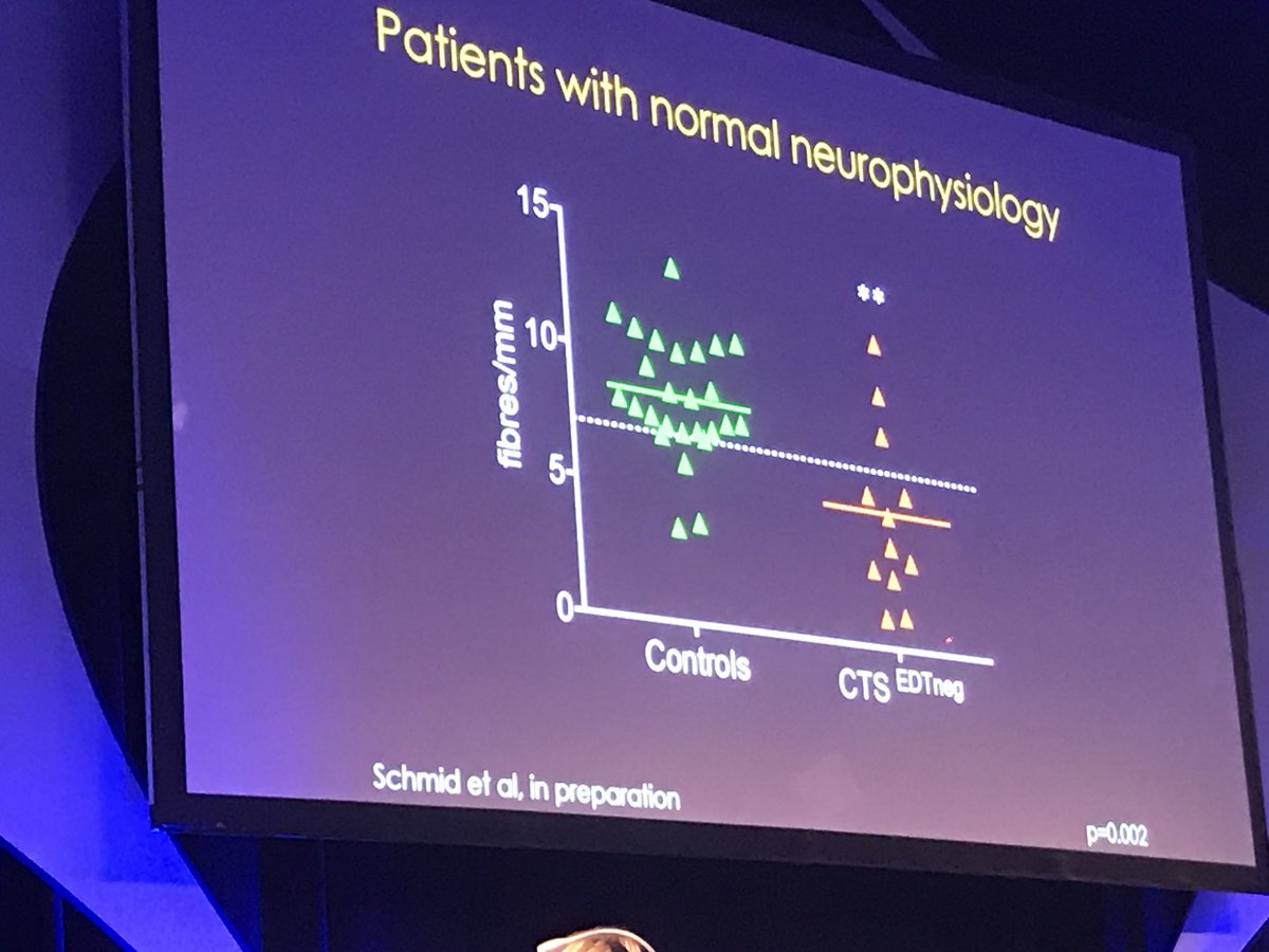lorenzo_masci's tweet photo. NORMAL studies do NOT exclude entrapment neuropathy as miss small fibres involvement. https://t.co/Y0GNZrKLPj