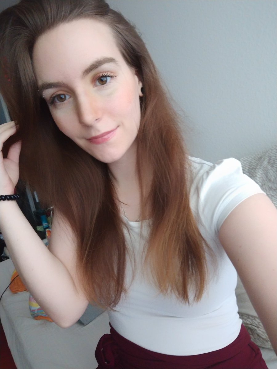 Hii, für die Meisten ist vielleicht kein Unterschied zu sehn, aber ich sehs extrem 😅 Bin zufrieden, Nase ist noch etwas geschwollen, Endergebnis bleibt abzuwarten 😊