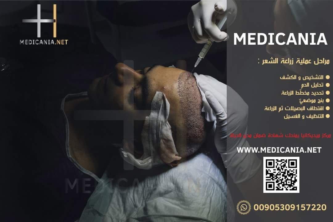 HamzeHamode's tweet image. حسومات فصل الربيع
خصم 400$ على كافة العمليات التجميلية
للاستفسار والتواصل مع الأخصائيين :
00905309157220
medicania.net
#ميديكانيا
#زراعة_الشعر_في_تركيا_اسطنبول
#زراعة_الشعر_في_تركيا
#زراعة_شعر #زراعة_اللحية⠀#عمليات_تجميل
#جمله_دايما_تحفزك
#الخميس_الونيس
#بريده_الان