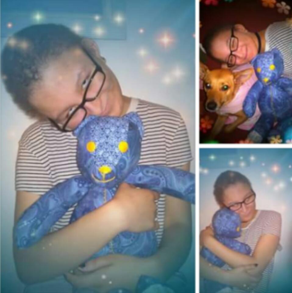 AdelleConexxion's tweet image. Today is the one-year anniversary of @JadeAbstract_  receiving her #RAREbear #Dare2BRare #OculoDentoDigitalDysplasia