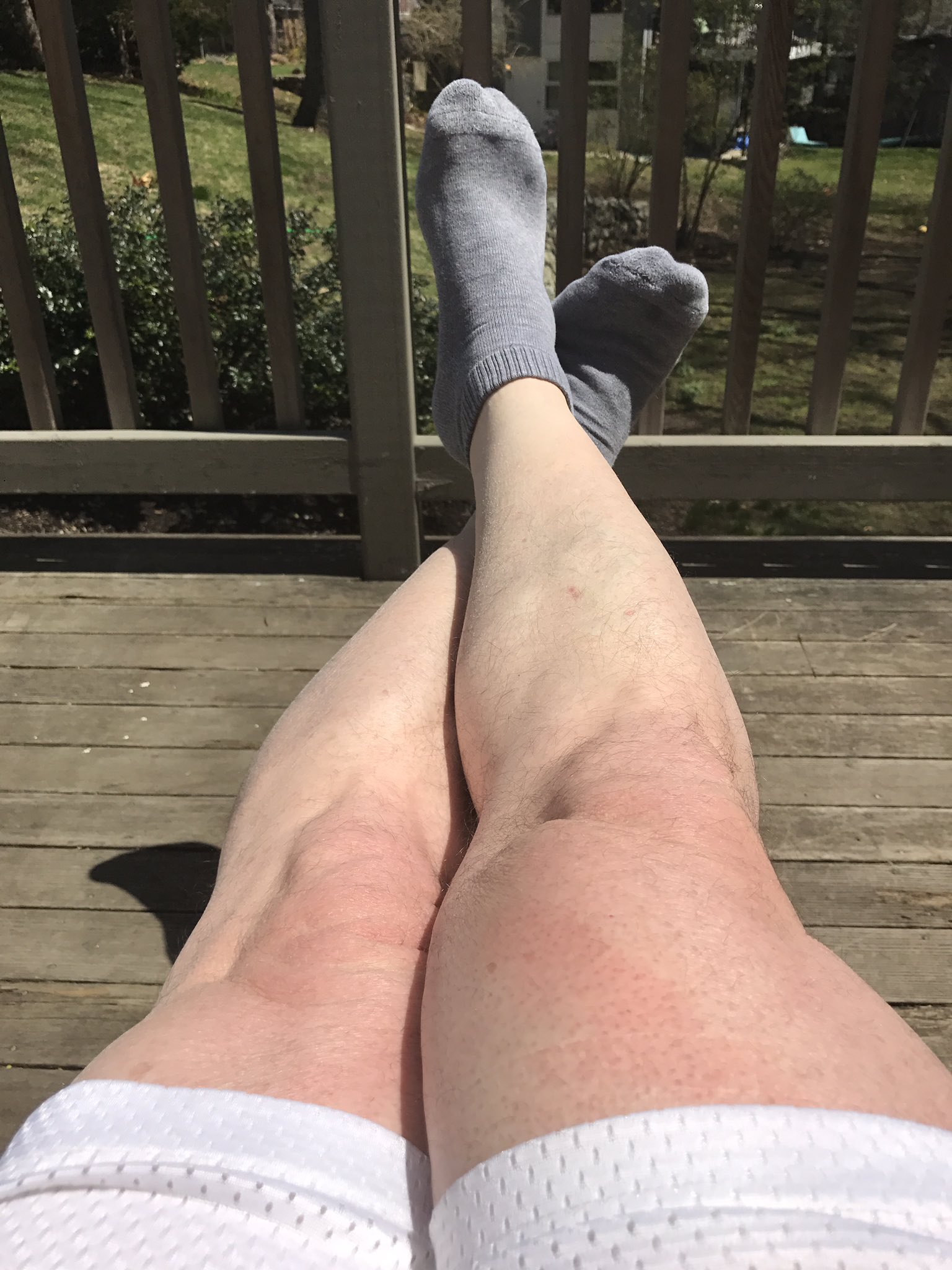 Adam Feuerstein ✡️ on X: I have old man winter white legs. Sun, help me!   / X