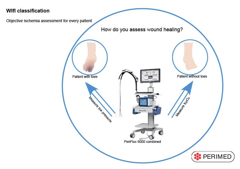 perimedgroup's tweet photo. We can help you out with your vascular diagnostic needs - stop by for a chat, booth #548, @SAWCMeeting #SAWCSpring2018 #peripheralarterialdiagnosis, #toepressure, #tcpoO2, #WIfIclassification https://t.co/LtKNaWrXua