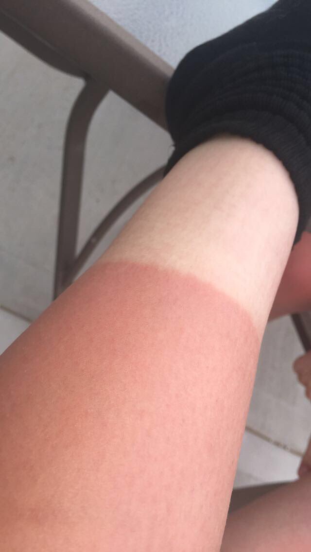 caitlin_e_18's tweet photo. call me larry the lobster #luvbaseball https://t.co/KTBtY1ukX1