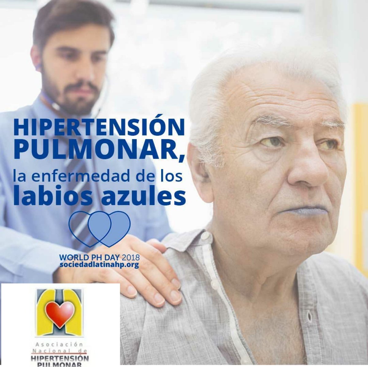 ANdHP's tweet photo. #hipertensiónpulmonar
#wphd2018
#pheurope2018 
#WorldPHDay2018 https://t.co/lzglSpL7Af