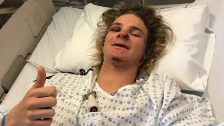 U.S. snowboarder Brock Crouch survives burying by avalanche near Whistler buff.ly/2r7RoM0