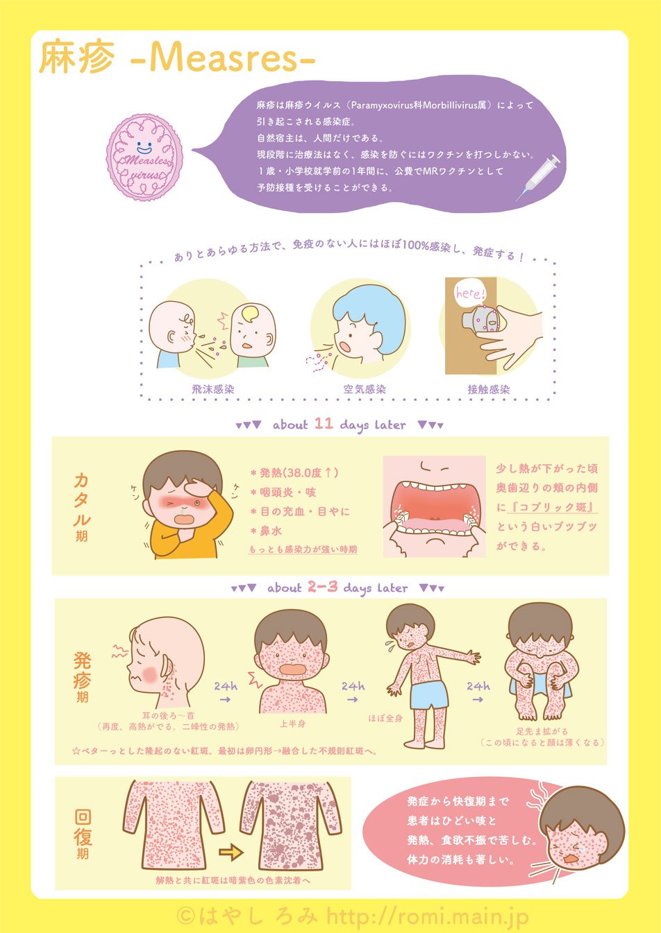 はやし ろみ 麻疹の簡単な病態 合併症とかもこれからかいていくつもり 麻疹 イラスト T Co Wtetojc6ac Twitter