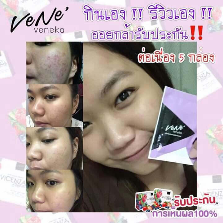 ninenfl's tweet photo. รีวิวโคตรแน่นนน #veneveneka #venevenekastemcell #เวเน่ https://t.co/4uUfJOf6e9