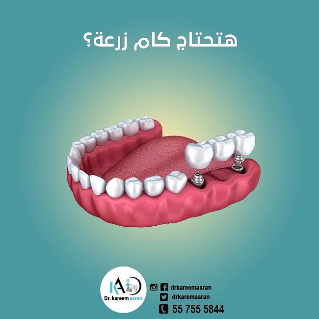 كن مطمئن ولا داعي للخوف من #سقوط_الاسنان
بعد #عملية_الزراعة فهي #الحل الامثل
لتعويض #الاسنان_المفقودة

#تقويم_اسنان
#زراعة_اسنان
#تركيبات_اسنان