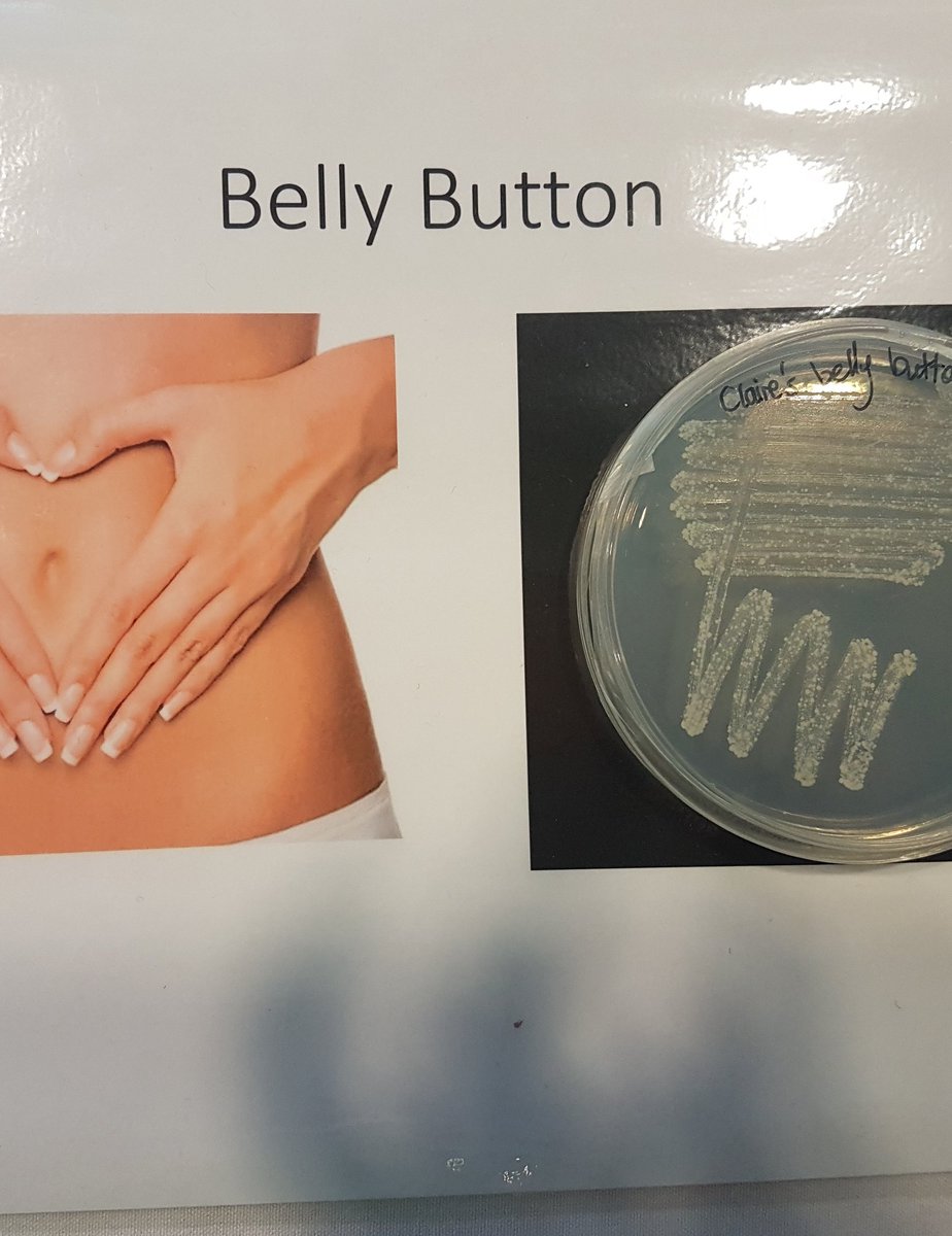 ImperialSpark's tweet photo. #SuperBugZone at #ImpFest shows us what miscroscopic marvels lurk on your body... eek!
@imperialcollege https://t.co/3oYMuMNRAM