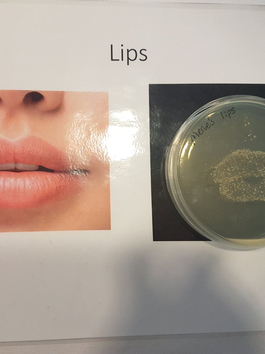ImperialSpark's tweet photo. #SuperBugZone at #ImpFest shows us what miscroscopic marvels lurk on your body... eek!
@imperialcollege https://t.co/3oYMuMNRAM