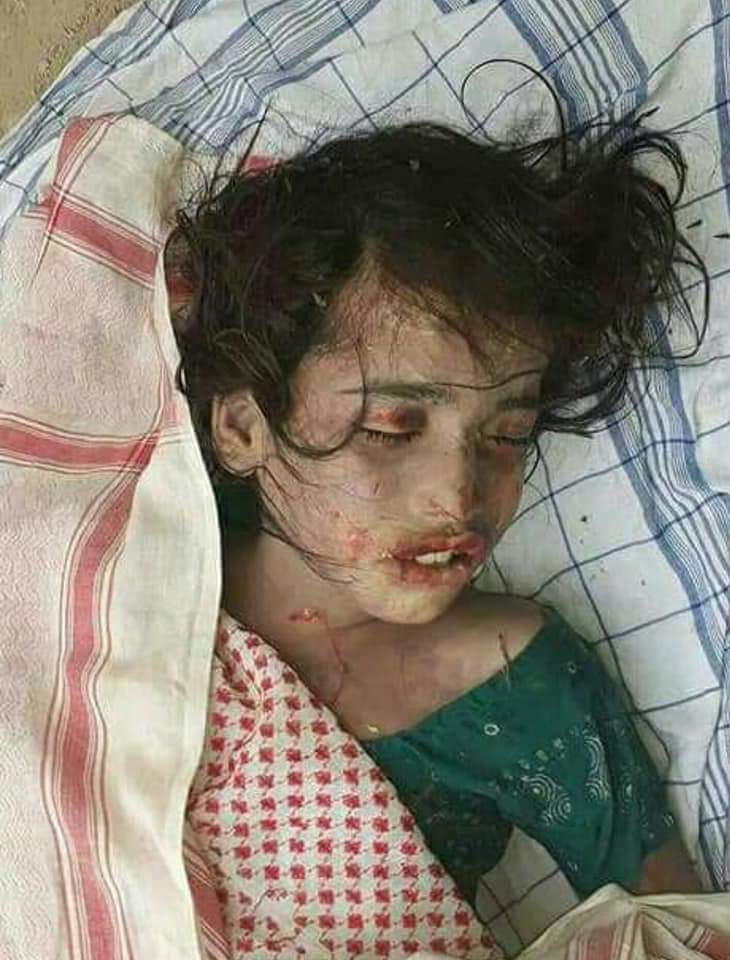 Sachal_Suhrab's tweet photo. ایسا معاشرہ جہاں عورت کے مردہ جسم کے ساتھ مرد اپنی جنسی حوس مٹاتا هو وہاں چلتی پھرتی بچی کے ساتھ حوس مٹانے والوں پے حیران نا ہونا بلکل بھی حیران کن نھیں۔

#JusticeForSaimaJarwar
#JusticeForSaima 
#Larkana 
#Pakistan https://t.co/ZSQyLx3Vaf