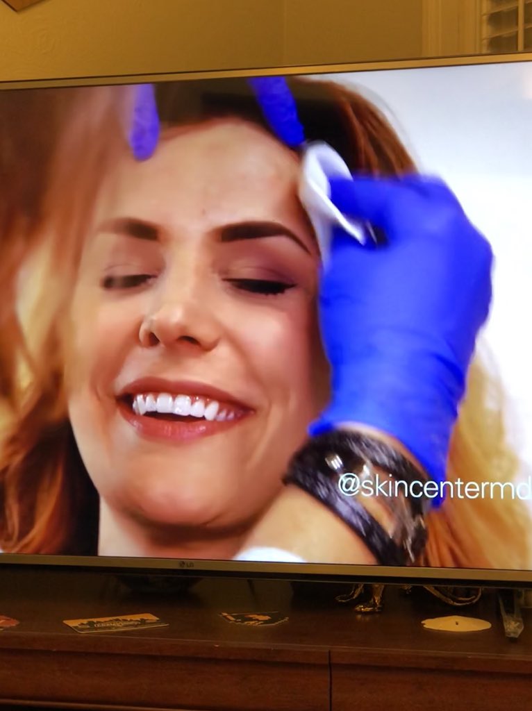 ald5300's tweet photo. Look at the beautiful @AbbyOnTheX on my @hulu #ilikeyourcommercialbest #girlyoudontneedthatbotox #yourekillingit https://t.co/G4JjFZU5bg
