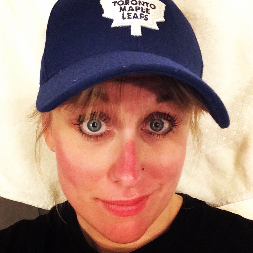 Jenndalen's tweet photo. Dear Universe, 
I would literally take this sunburn right now if it meant no more snow! Please continue to send sunshine! 
Love,
Jenn 🙊 #sacrifices #sendsummer #neverendingwinter https://t.co/jjEfXoGVCy
