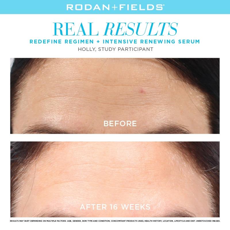 RodanFieldsHQ's tweet photo. We live for results like this. #RFBeforeAndAfter #RodanandFields https://t.co/RwDwiUoRyY