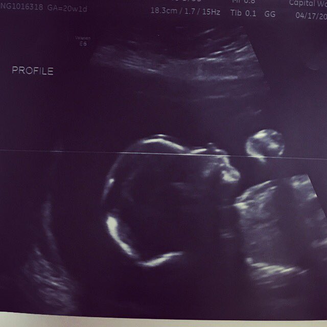 akmdit's tweet photo. My perfect little granddaughter 💕 https://t.co/pM1jvm4vWm