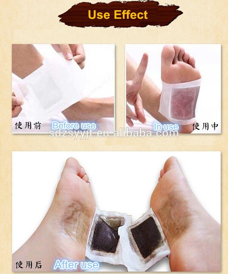 skgh2012's tweet image. #FOOTPATCH FDA＆SGS Approved @PatchitUK Patch From Zhushi China， Direct manufacturer with good quality and very competitive price