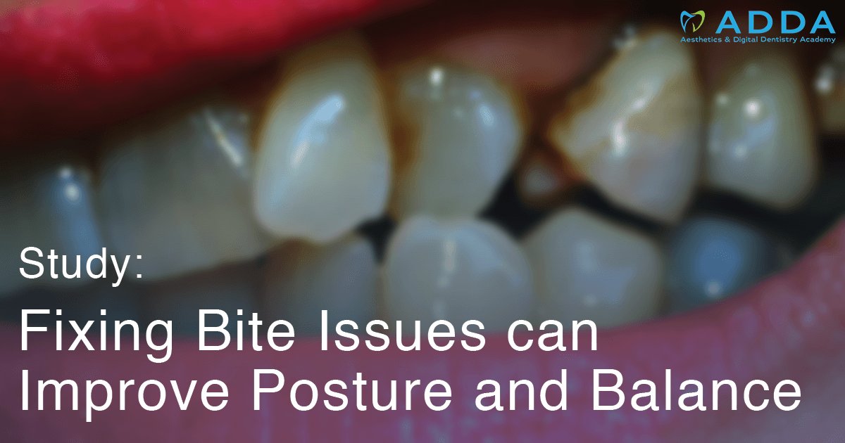 adda_sg's tweet image. Study: Fixing Bite Issues Can Improve Posture and Balance - is.gd/mIu1jF #Blog #biteissues, #dentistry, #invisalign, #smilemakeover, #veneers