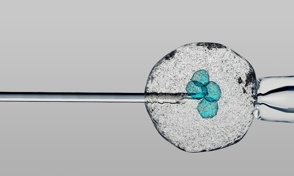 fusi79's tweet photo. #CellDynamics lancia sulla piattaforma #crowdfunding @BacktoWork24 una raccolta di capitali mirata all’industrializzazione e all’ingresso nel mercato del proprio prodotto, #CellViewer
#startup #innovation https://t.co/cvwogif7LE