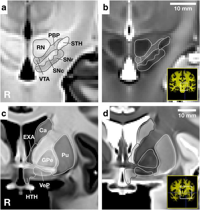 A high-resolution probabilistic in vivo atlas of human subcortical brain nuclei dlvr.it/QPyP53 v/ @NatureNews