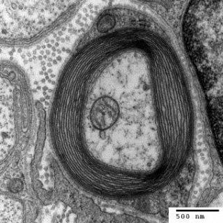 ForCmt's tweet photo. The peripheral nervous system also comprises motor and sensory nerve fibers, and since CMT affects the peripheral nerves, it usually results in both motor symptoms (weakness and muscle wasting) and sensory symptoms (numbness). https://t.co/sg35OvCMB6