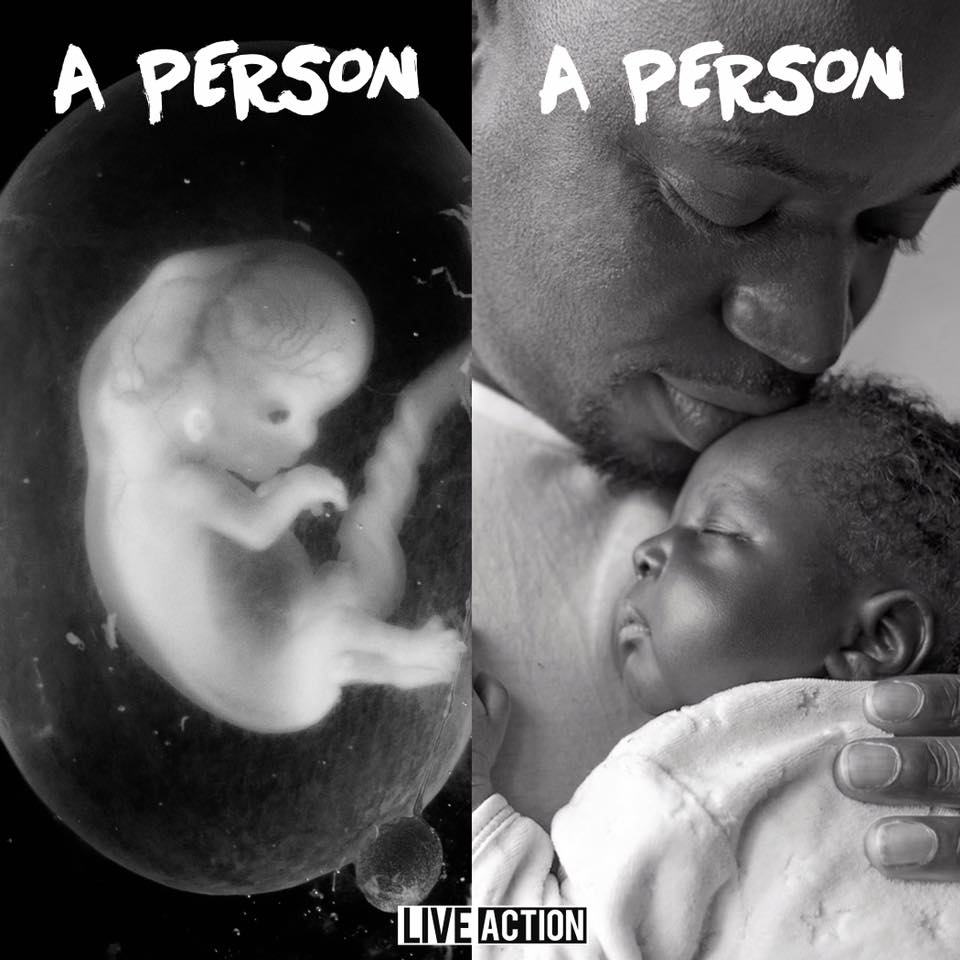 LiveAction's tweet photo. I was human then, I am human now. I’m a person who only needs time and nourishment to grow. Will you speak up for my right to life? https://t.co/ezQhj5z8Ei