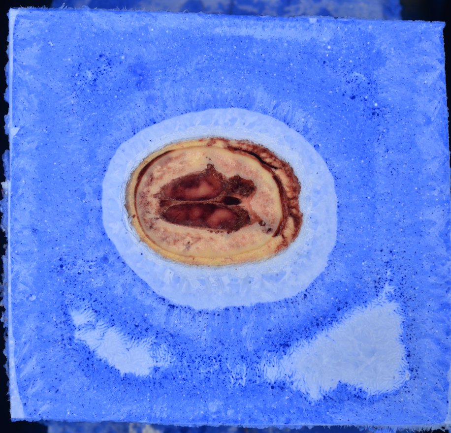 TouchofLifeTech's tweet photo. Here is a slice through the top of the head. The skill can be seen around the perimeter, dura surrounding the brain, and a bit of the gyri & sulci in the center. The cut isn't through the brain just yet, we are seeing it through the CSF!
#visiblehuman
#3danatomy
#medicine https://t.co/z5kUr0LFAu