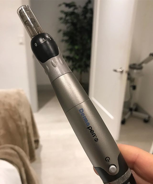 skinglowlaser's tweet photo. Our ✨MAGIC WAND✨ - our staff and clients favourite treatment - Dermapen 3 micro needling targets a wide range of skin concerns using a natural non invasive method of stimulating your body’s natural healing response to repair and improve the look and … https://t.co/HRTyaMAIEY https://t.co/ujjWzS24ct