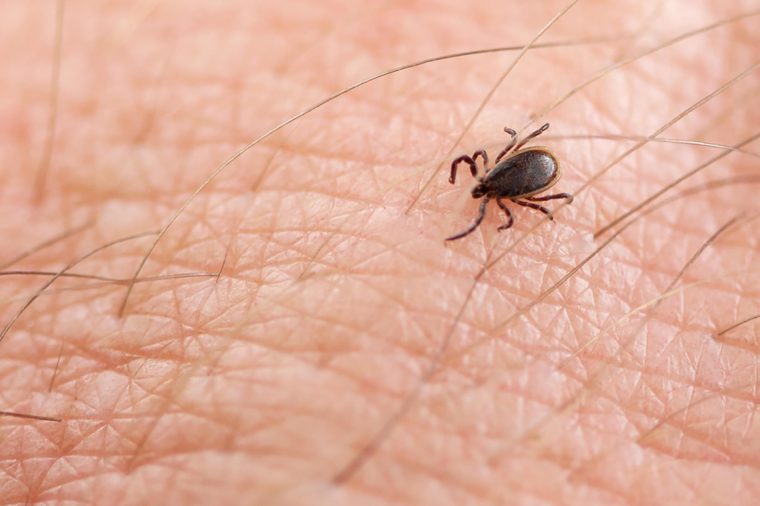 What to Do if You're Bitten by a Tick | Reader's Digest - bit.ly/2uQRo7q