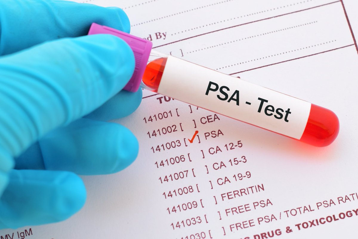 MT @pcfnews: RT to all the men in your life on this #WellnessWednesday & remind them to learn their family history & get a #PSAtest, esp. if a family history of #prostatecancer. If caught at its earliest stages, most men will not experience any symptoms.