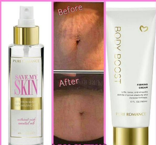 pure romance stretch mark cream