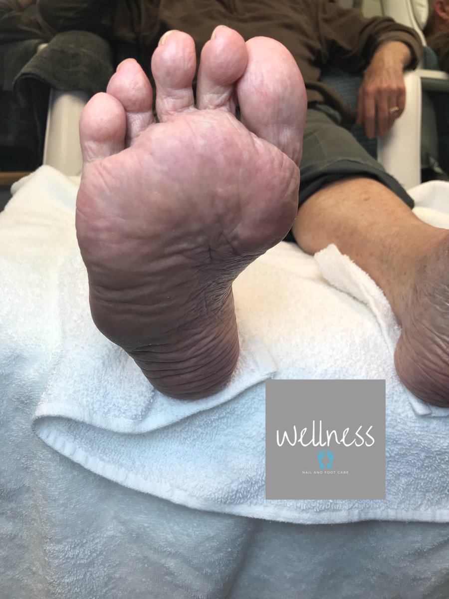 WellnessFoot tweet picture
