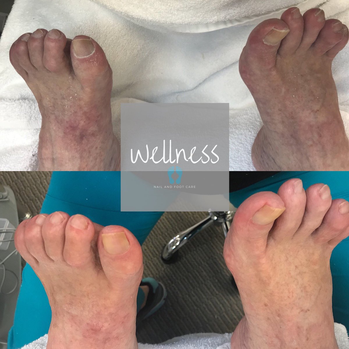 WellnessFoot tweet picture