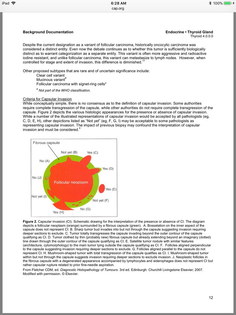 BinXu16's tweet photo. @pranavp01 Thyroid has definition for capsular invasion. Cap attached. https://t.co/9hXgKo6vmE