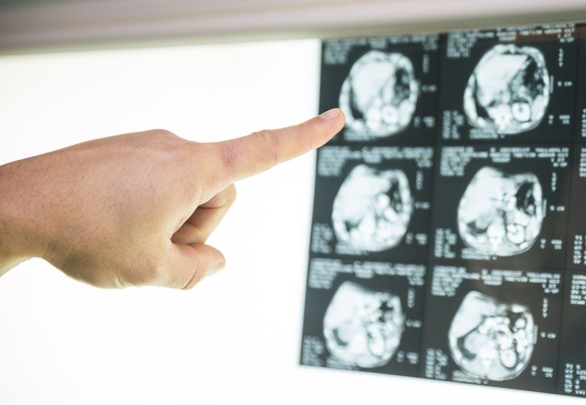 LowCarbProgram's tweet photo. A large body of #evidence suggests that a very #LowCarb, #ketogenicdiet is particularly effective at reducing the frequency of #epilepticseizures in #children.
#LCHF #Keto #Epilepsy #ChildrenWithEpilepsy - https://t.co/kyBwKn9kNf https://t.co/683DxcnRA3