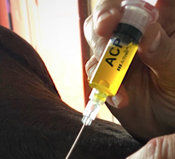 Treatment of overriding spinous processes or “kissing spines” with #StemCellTherapy. #Horse #HorseHealth #GetADiagnosis #GetTheFacts #InternistOnTheRun #MobileImaging #GetOutAndRide #Arthrex #ArthrexVetSystems #PlateletRichPlasma #PRP