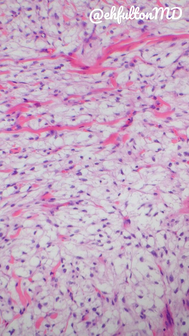 Edward Fulton, MD tweet media