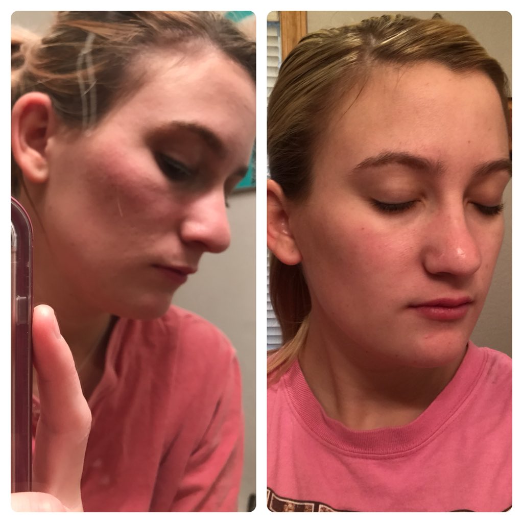 lushlipbeauties's tweet image. My skin has never felt or looked better, all thanks to @SeneGence_Intl  and the amazing skin care products I use. This is just my results from ONE WEEK. The difference feels amazing, and the texture of my skin feels so smooth! 🙌🏻 #askmeaboutit