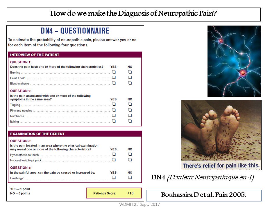 NaveenEipe's tweet photo. @garyschwartzmd @Neuro_Kellie @ankeetudani @ASRA_Society @EMARIANOMD @jonhagedornmd @DrMStiegler @amit_pawa @DrJeniMD @ESchwenkMD @DoctorSivaMD @docroland @AmyPearsonMD @DanWarrenMD @PainDocGoel @dr_rajgupta @chadptmd @nelkassabany @paulhting Probably important to identify &amp; treat acute hyperalgesia aggressively?
Anti Hyperlagesics (Pregabalin, Lidocaine &amp; Ketamine etc.) improve both acute pain Mx &amp; prevent development of chronic pain.
Using DN4 may diagnose #ProNociception 
@cpaolag @colinjmccartney https://t.co/E8NmLwJD1K