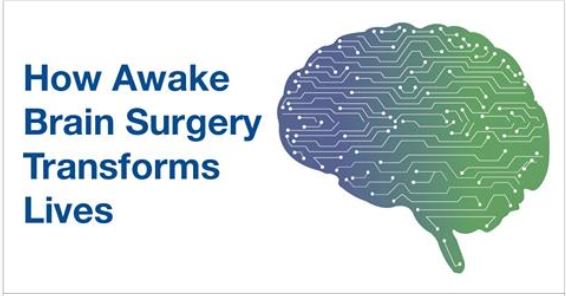 Mayo Clinic Neuro tweet media