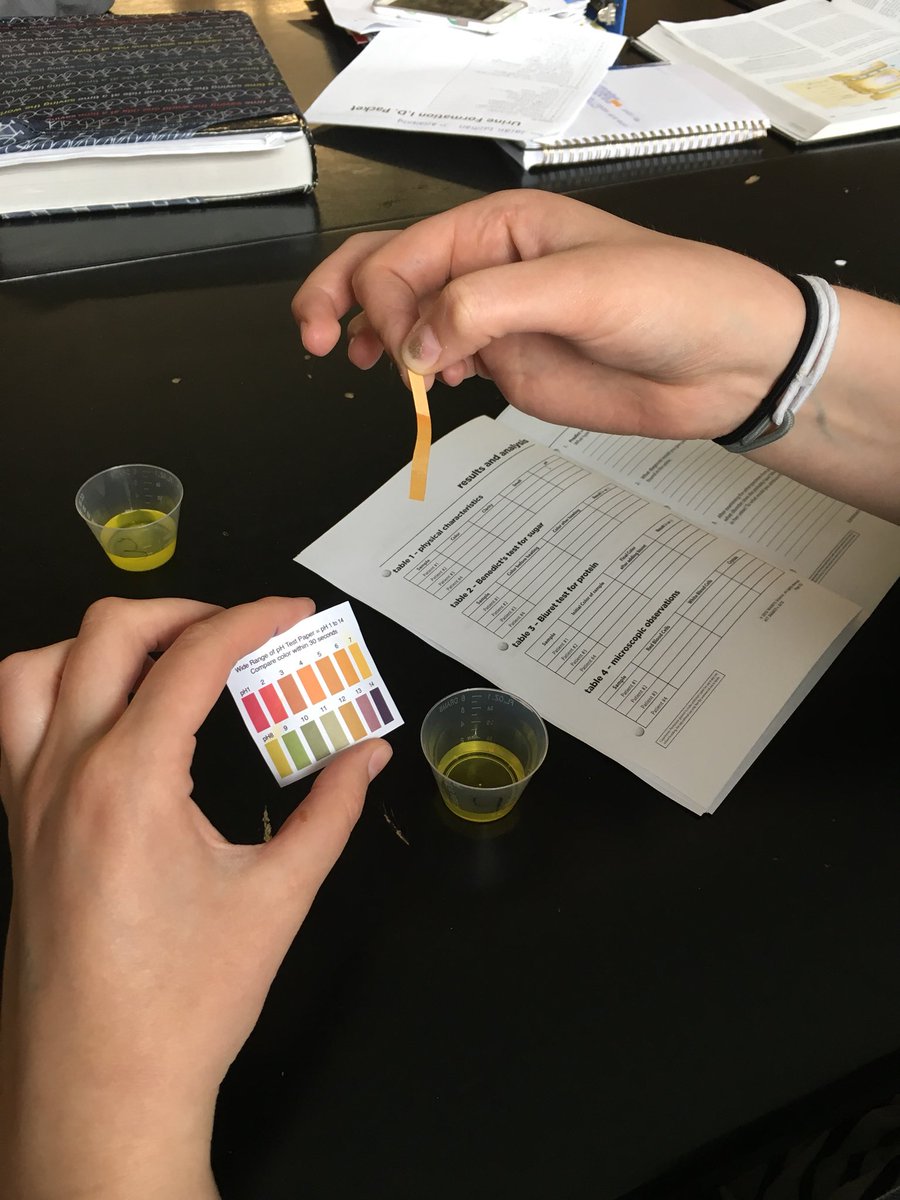MrsRegovich's tweet photo. Urinalysis Lab today in #anatomy!! Students are trying to figure out what's wrong with our 4 patients by testing their #urine samples. โ๐ผ๐๐ฝ #whatcolorisyourpee #waftinglikeachamp #pH #sugartest https://t.co/535rbwIV7I