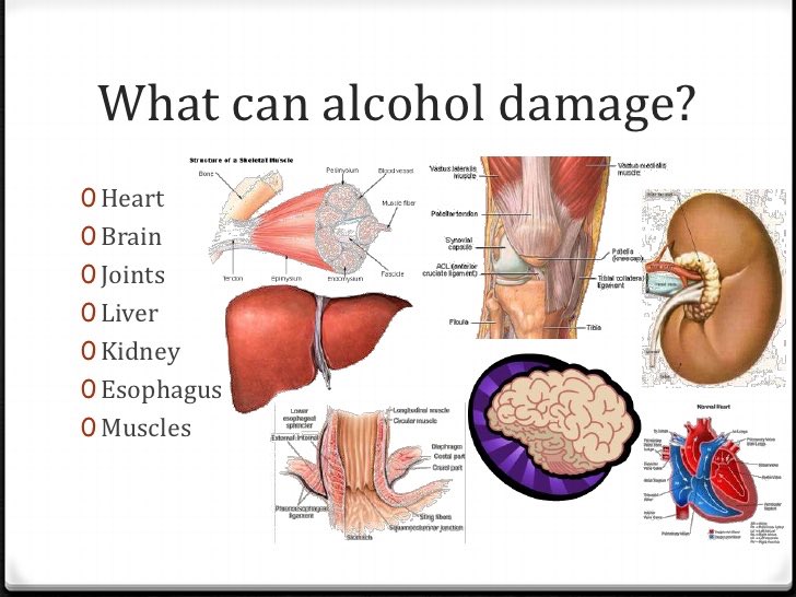 StopD_StartT's tweet photo. @meljohns0n @JessicaTehan There were about 189,000 emergency room visits for minors with injuries and complications related to alcohol consumption! #stopbingedrinking #startthinking https://t.co/q2Qg28KYu6