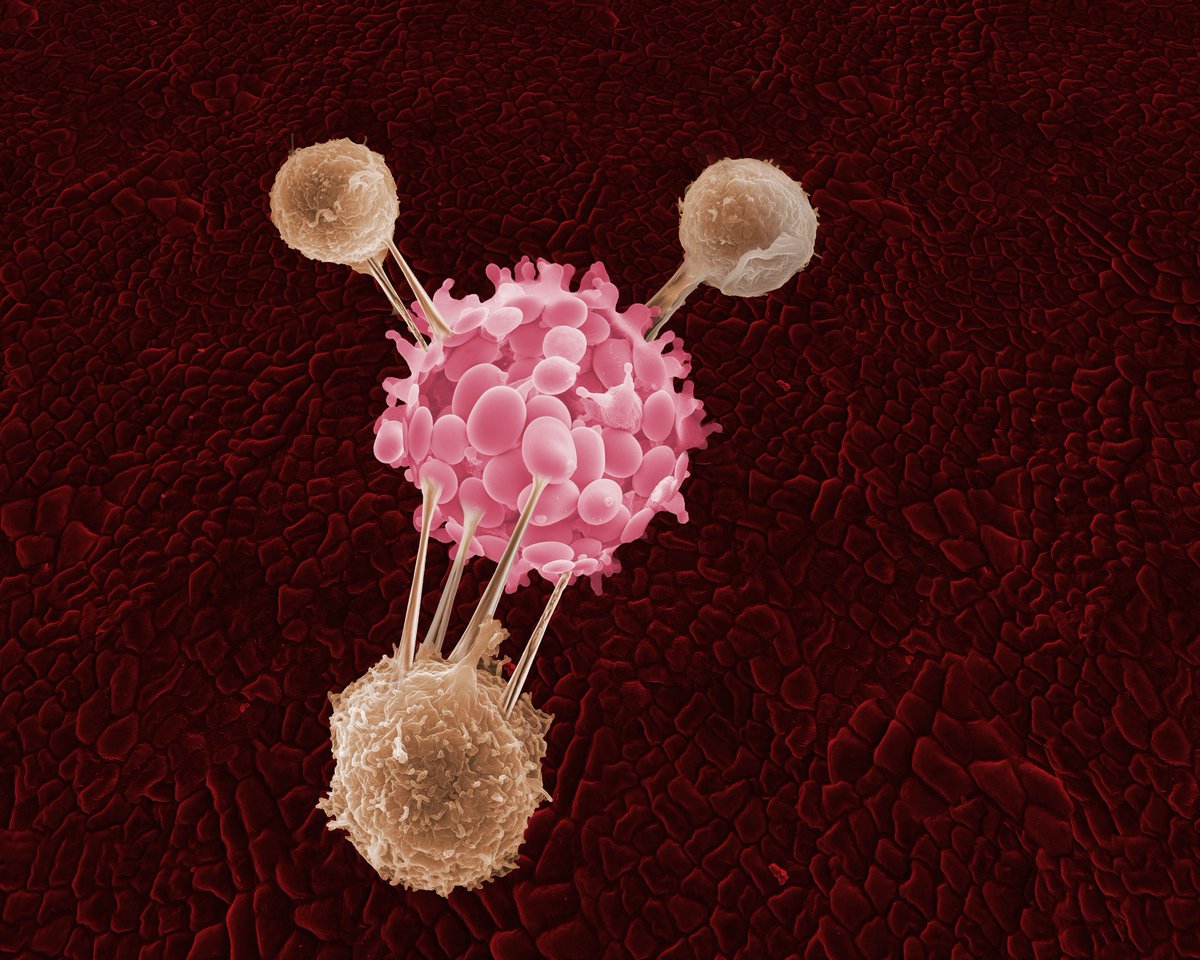 Georgia Tech engineers developing a laser that can fire up the body's T-cells  to attack cancer. #CreatingTheNext | c.gatech.edu/2F06cAH