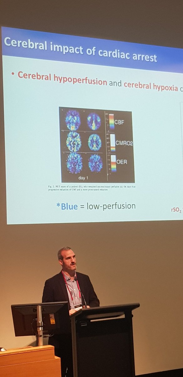 EmergEdu's tweet photo. Dr Glenn Eastwood @Eastwoodgm discussing the cerebal impact of cardiac arrest... the larger cause of death. #ResusUpdate @AlfredHealth https://t.co/EjCN5i0w7V