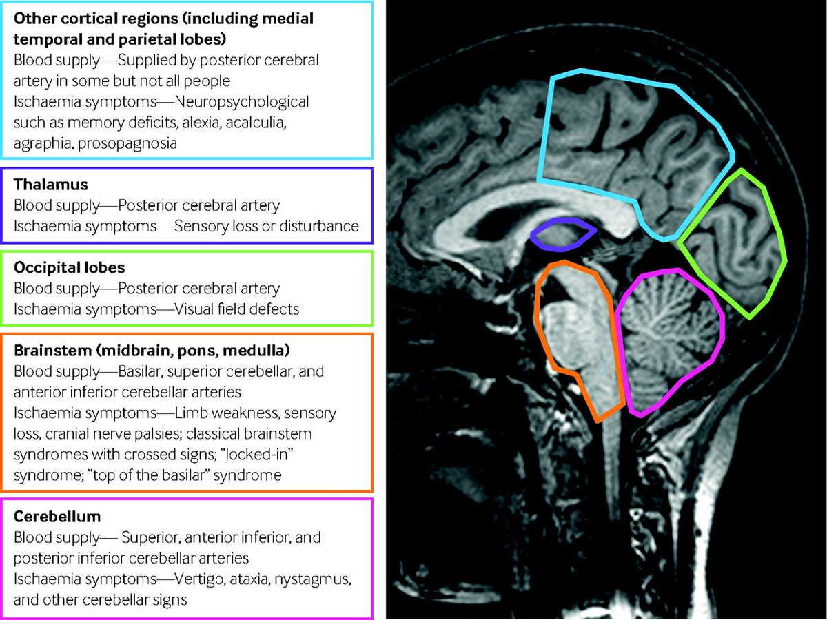 bmj_latest's tweet photo. Posterior circulation stroke causes a wide range of non-specific presenting symptoms. Here's what you need to know to spot this condition https://t.co/uT2BUY45S5 #BMJPractice https://t.co/oitAYk1L5g