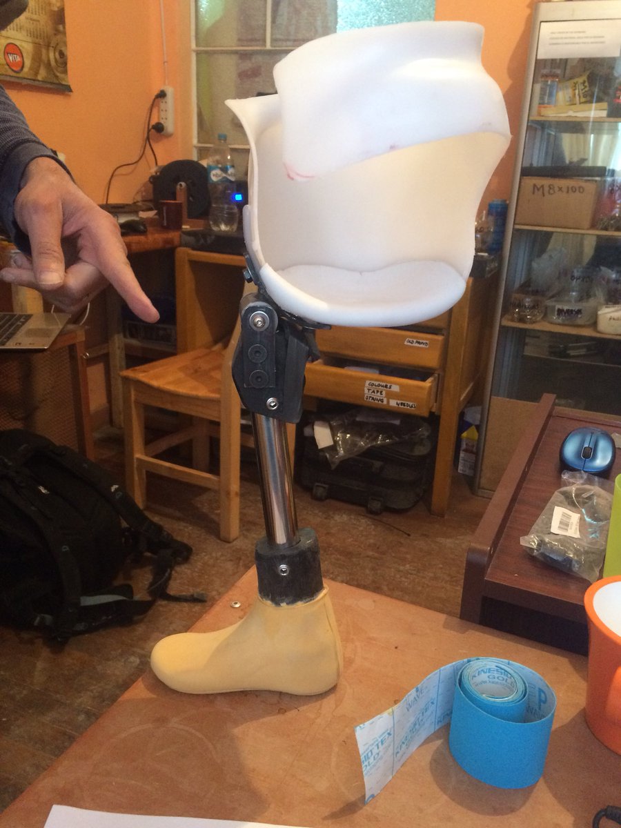 FUNPROBO's tweet image. The little recipient of this amazing prosthesis is even more of a cutie than this limb suggests 😍👶🏼 great work from @prosthetika with @FUNPROBO