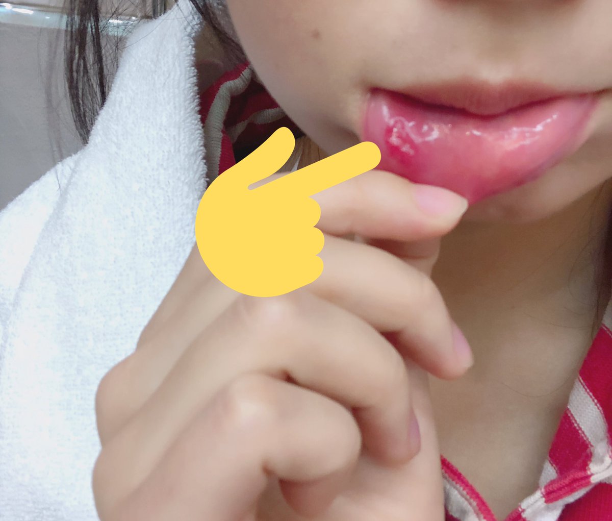 Ramu No Twitter 今日は朝から撮影してるお そして久々に巨大口内炎だよ 噛んだ時はめちゃくちゃ血出た T Co Brjrcrbbyg Twitter Ramu No Twitter 今日は朝から撮影してるお そして久々に巨大口内炎だよ 噛んだ時はめちゃくちゃ血出た T Co Brjrcrbbyg Twitter